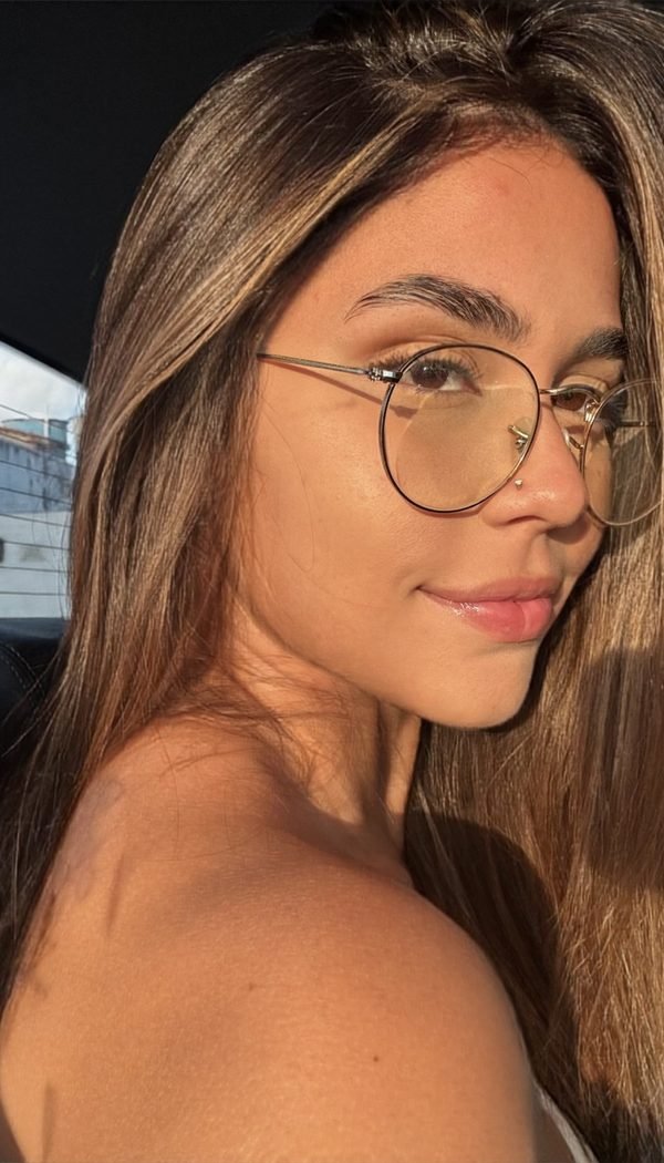 Traços harmônicos após procedimento