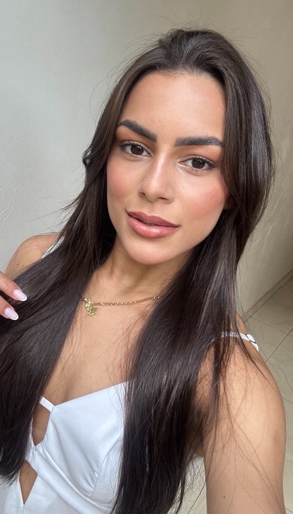 Resultado de harmonização facial com naturalidade